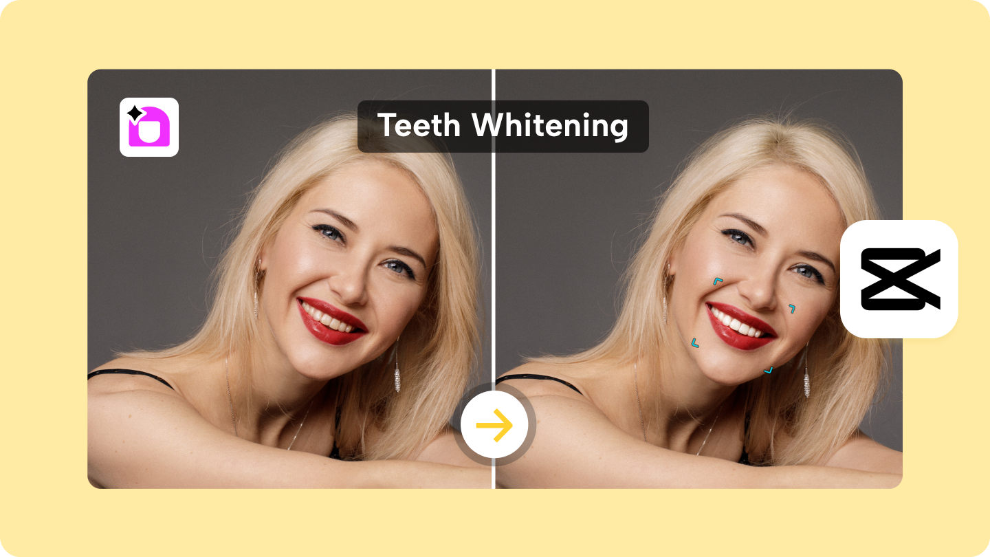 Professional Teeth Whitening Cost: What You Need to Know 